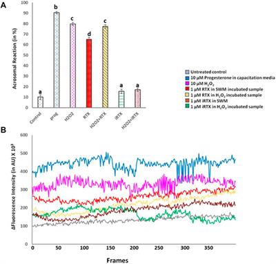 TRPV1 channel in spermatozoa is a molecular target for ROS-mediated sperm dysfunction and differentially expressed in both natural and ART pregnancy failure